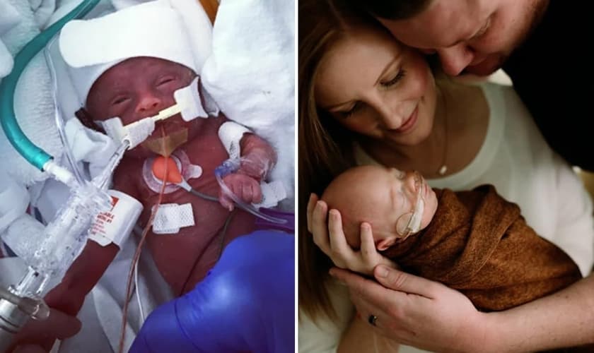James “Finn” Hill na UTI Neonatal (à esquerda) e com seus pais Chris e Jessica após alta hospitalar. (Foto: Reprodução/Facebook)