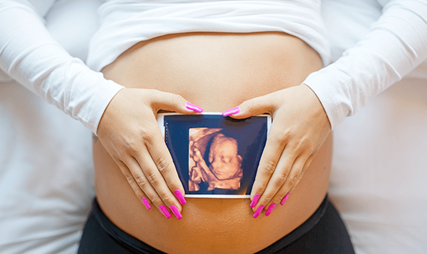 Ultrassom 3D. (Foto: Reprodução/Canstockphoto)