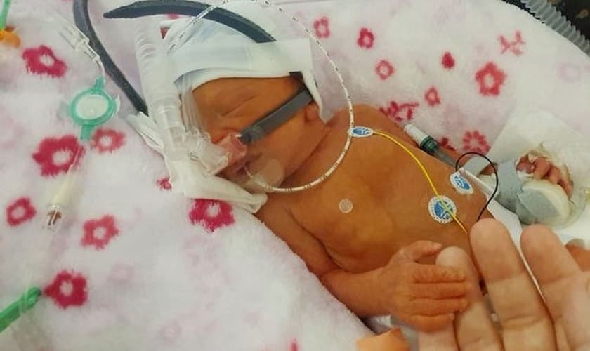 Kirsty Mizon segura a mão de sua pequena Lacey, que tem desafiado as probabilidades, ao lutar por sua vida. (Foto: Burton Mail/ Kirsty Mizon)