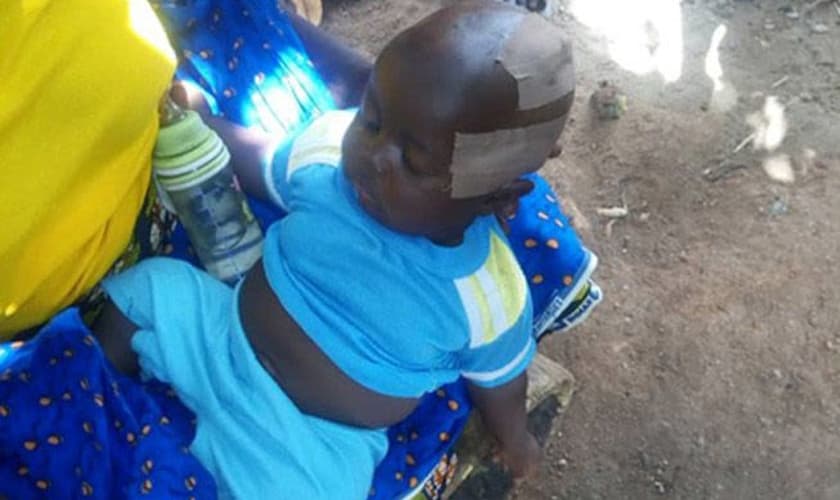 Criança nigeriana foi ferida em ataque Fulani que tirou a vida de seu pai. (Foto: Barnabas Fund)
