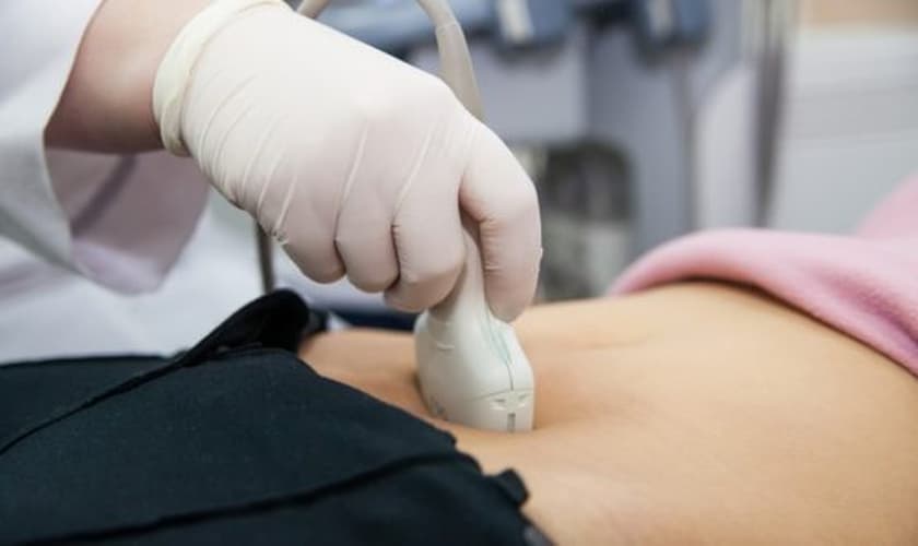 Ultrassonografia em gestante. (Foto: Reprodução / IMMEF)