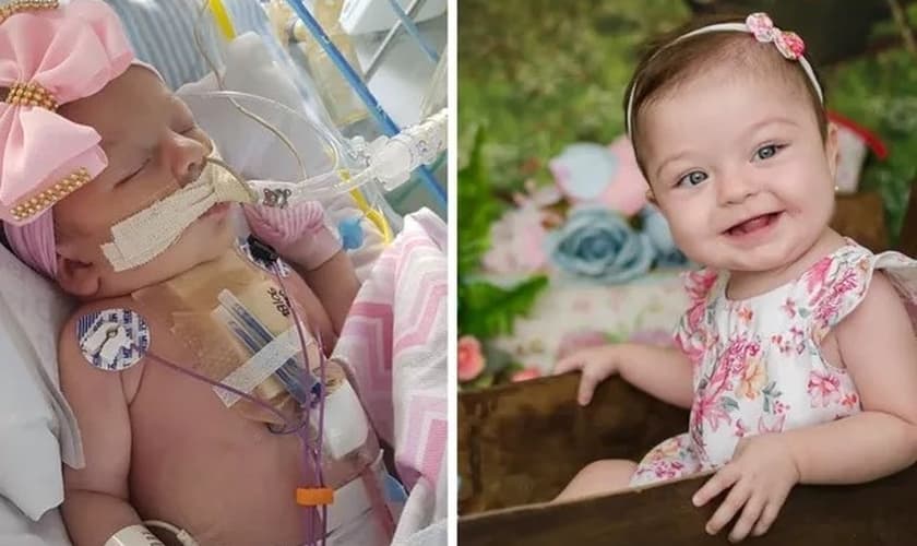 Ayla durante internação, e hoje, com 1 aninho. (Foto: Reprodução / Arquivo pessoal)