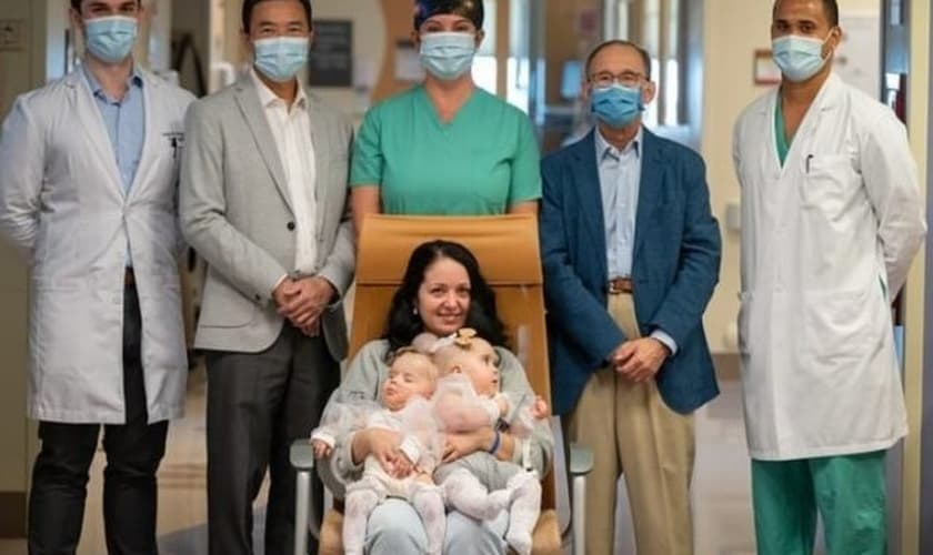 Liliya segurando suas filhas gêmeas unidas com a equipe da UC Davis. (Foto: Reprodução / GODTV)