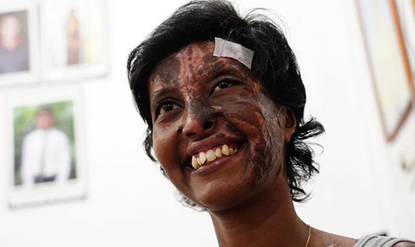 A cristã Rebekah com marcas da explosão feita por terroristas em uma igreja no Domingo de Páscoa. (Foto: Reprodução / UGCN)
