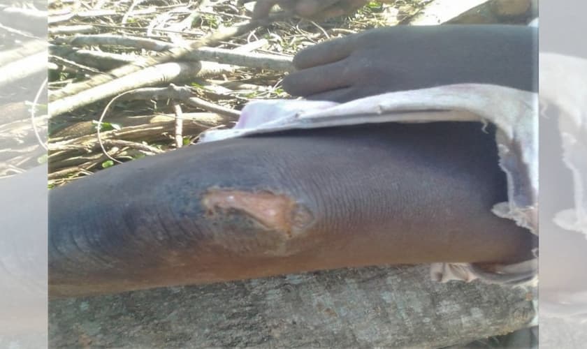 Lesão no joelho de uma menina de 10 anos atacada no leste de Uganda em 24 de janeiro de 2021. (Foto: Reprodução / Morning Star News)