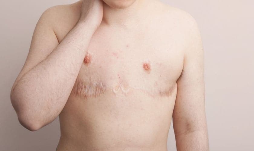 mbar, atualmente com 21 anos. Começou o tratamento hormonal aos 17, fez mastectomia e histerectomia aos 18. “Para mim a transição foi uma espécie de autoflagelação, estava tentando destruir a pessoa que eu era”. (Foto: Laura Dodsworth)