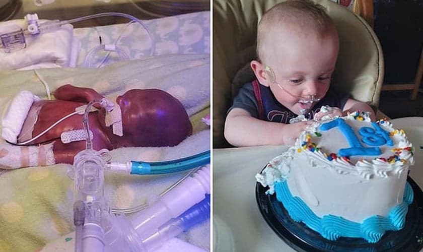 Richard Scott William Hutchinson, menor bebê do mundo, completou 1 ano. (Foto: Guinness World Records)