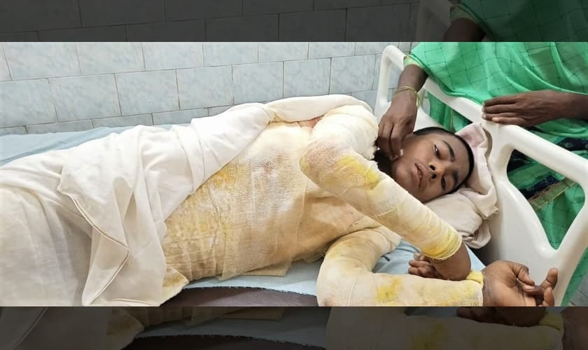 Ataque na Índia deixou Nitish Kumar, 14 anos, com queimaduras em 65% do corpo. (Foto: Morning Star News)