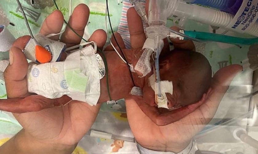 O bebê Curtis Means nasceu com 500 gramas e tinha apenas 1% de chance de sobreviver. (Foto: Arquivo pessoal/Michele Butler).