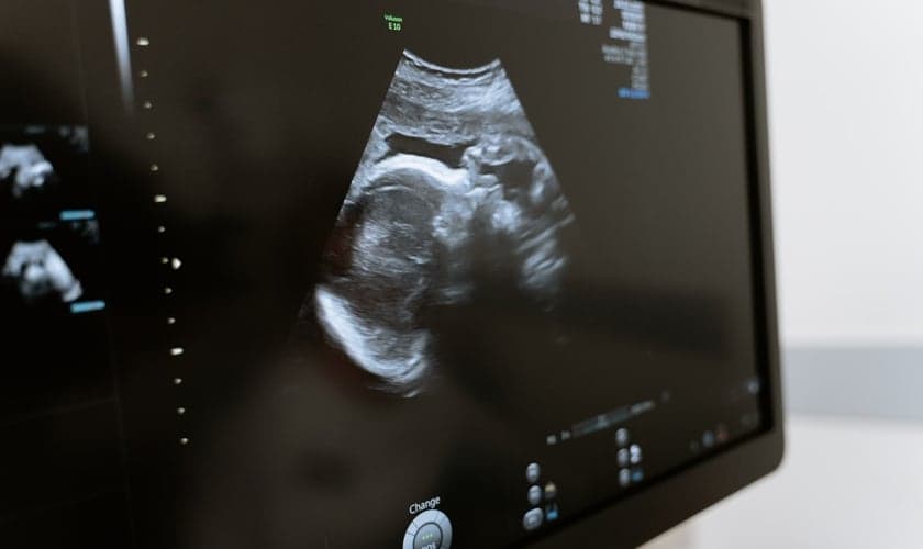 Ultrassom de feto. (Foto: Reprodução / Pexels)