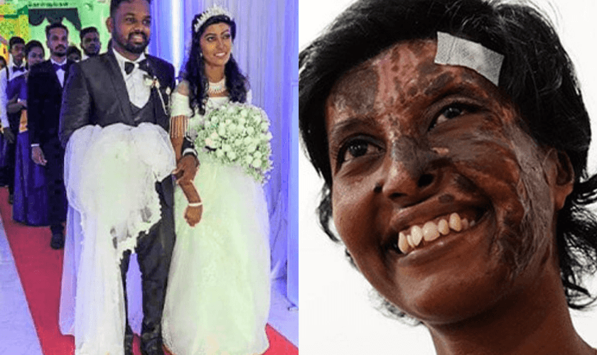 Rebekah em seu casamento com Kaushik; ao lado, após sofrer queimaduras durante ataque em 2019. (Foto: Reprodução / Open Doors)
