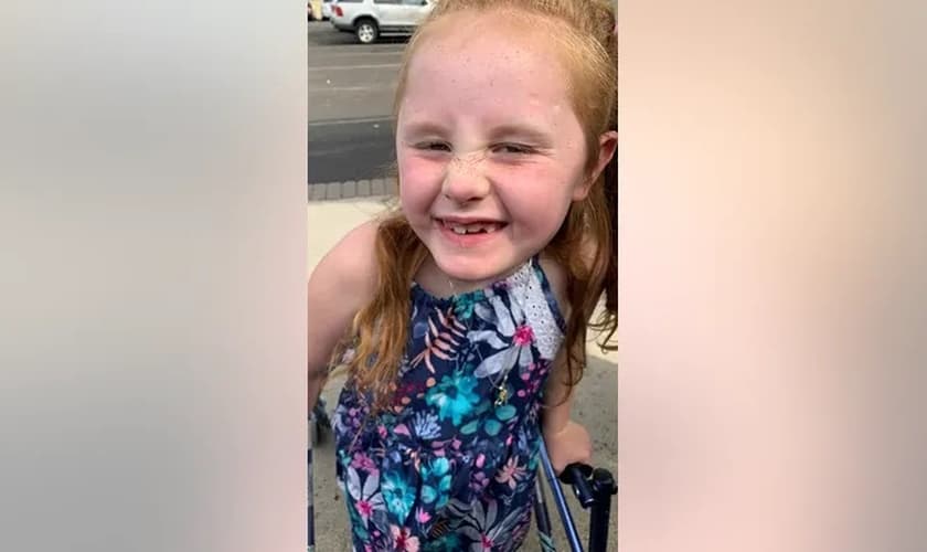 Shaylie Edwards foi atropelada por um carro quando tinha apenas 3 anos enquanto atravessava a rua com o pai.  (Foto: Erica Edwards)