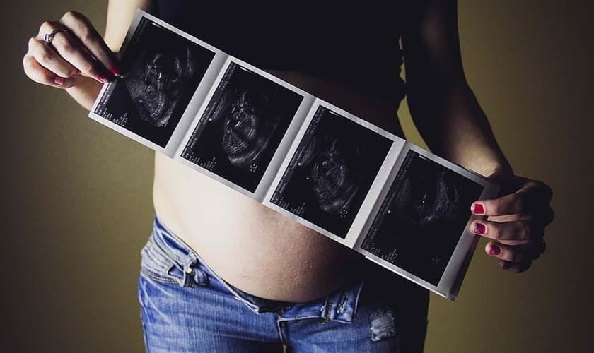 As pesquisas dizem que a maioria da população apoia o direito ao aborto na Espanha. (Foto ilustrativa: Piqsels)