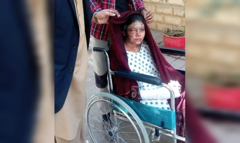 Sunita Masih, de 19 anos, sofreu queimaduras em 20% de seu corpo. (Foto: Morning Star News).