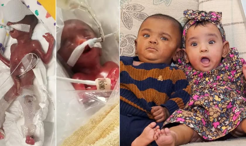 Os gêmeos mais prematuros do mundo. (Foto: Reprodução/Guinness World Records)