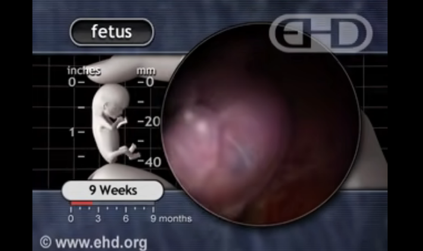 Imagens de ressonância magnética de um embrião humano de nove semanas. (Captura de tela/YouTube/ehdvideos)
