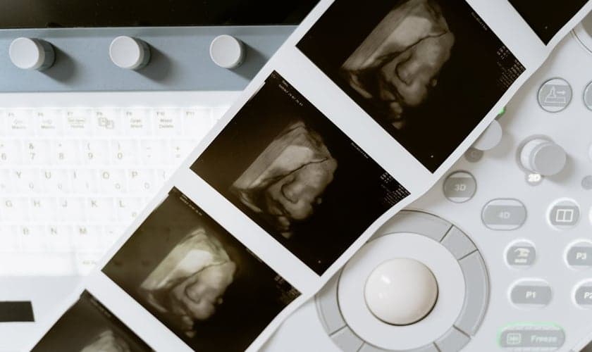 Atualmente, o aborto é permitido até a 24ª semana de gestação. (Foto: Pexels/Mart Production)