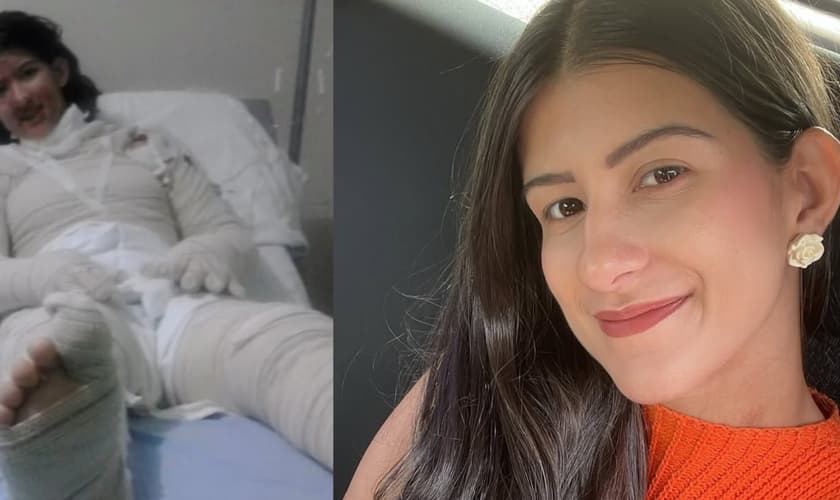 Gabriela Schell sobreviveu a um grave acidente com fogo. (Foto: Reprodução/Instagram/Gabriela Schell).