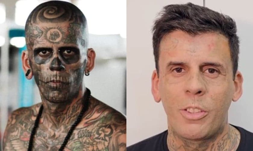 Leandro de Souza passou por mais uma sessão de remoção das tatuagens no rosto. (Foto: Arquivo pessoal/Reprodução/Instagram/Hell Tattoo).