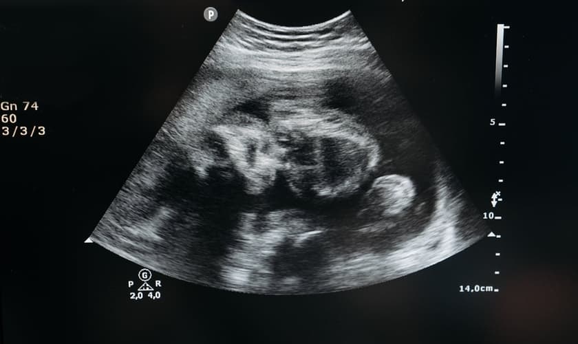 Mudança no Código Civil reconhece personalidade legal ao feto. (Foto: Pavel Danilyuk / Pexels)